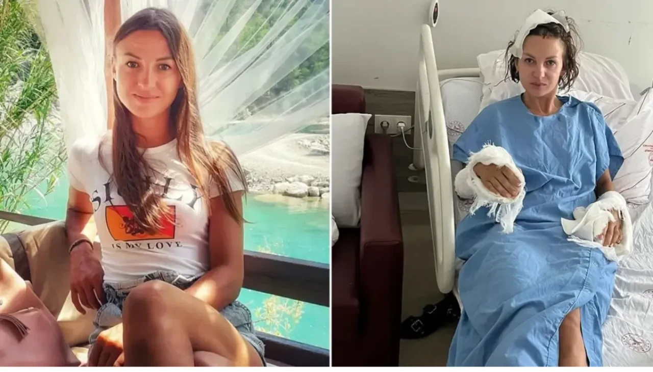 Yer Antalya! Ukrayna asıllı kadın sopalı saldırıya uğradı