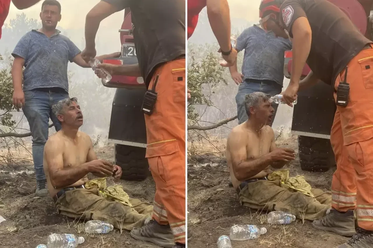 Eşi paylaştı! "Yanıyorum!" diyerek feryat eden orman işçisinin son hali