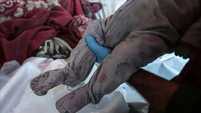 Gazze'deki Sağlık Bakanlığı: Yetersiz beslenme nedeniyle 52 çocuk şehit oldu, sayı daha da artabilir