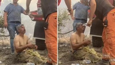 Eşi paylaştı! "Yanıyorum!" diyerek feryat eden orman işçisinin son hali