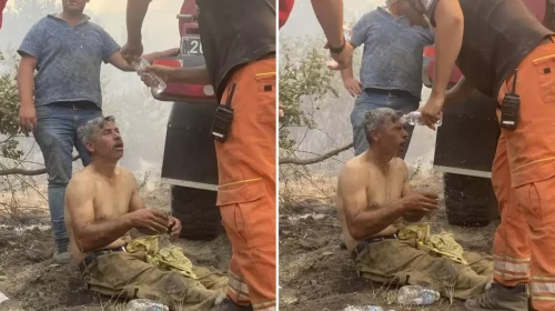 Eşi paylaştı! "Yanıyorum!" diyerek feryat eden orman işçisinin son hali